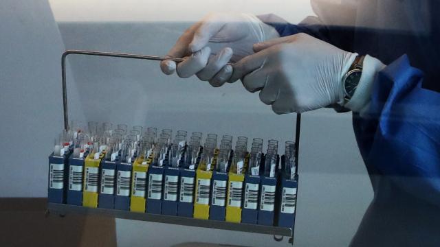 Güney Kıbrıs’ta 3 can kaybı, 6 bin 494 yeni Covid-19 vakası